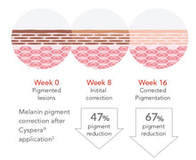 Load image into Gallery viewer, Cyspera® Intensive Pigment Corrector