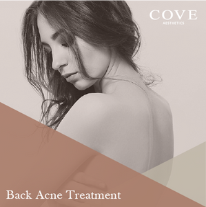 Back Acne Treatment